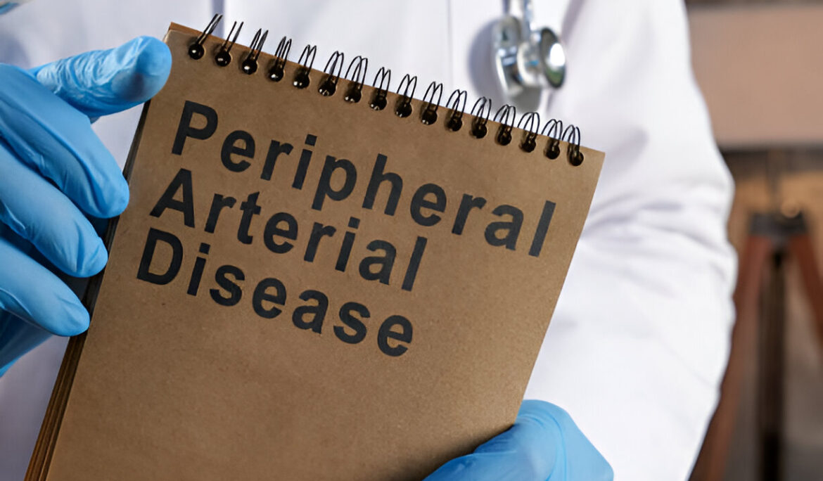 7-Peripheral-Artery-Disease-Symptoms-(PAD) - Empat Pillar Medika