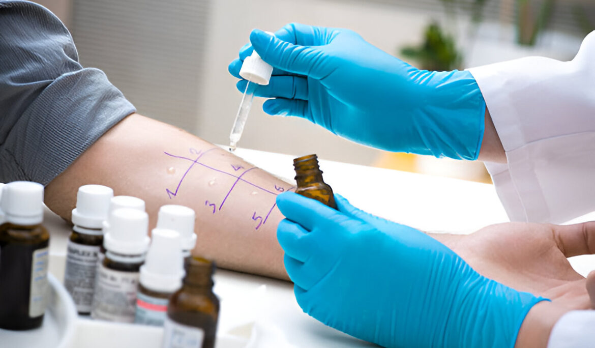 What Are Allergies? Understanding 5 Common Allergens and Their Treatments - Empat Pillar Medika