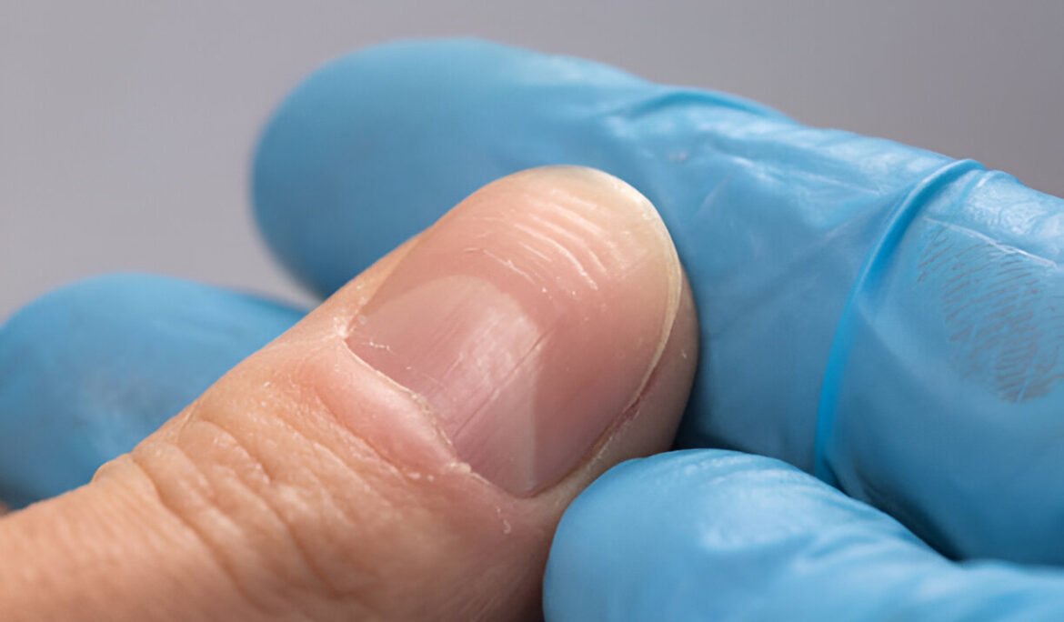 10 Signs of Calcium Deficiency, and What You Can Do About It - Empat Pillar Medika