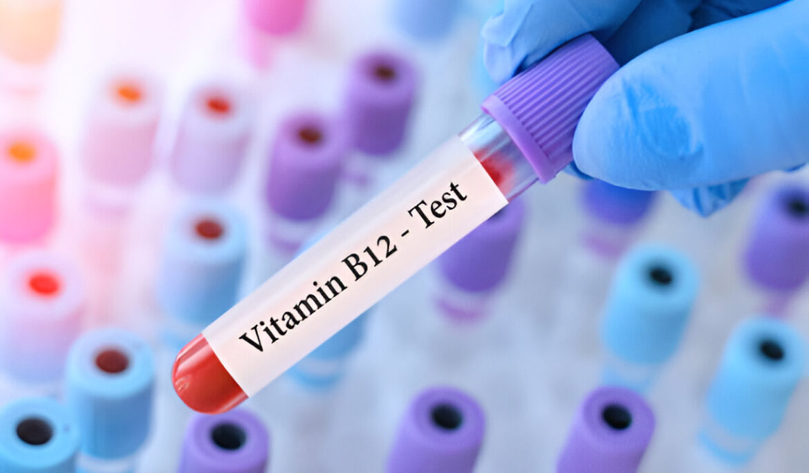 Vitamin B6 vs B12: Unraveling the Essential Nutrients - Empat Pillar Medika