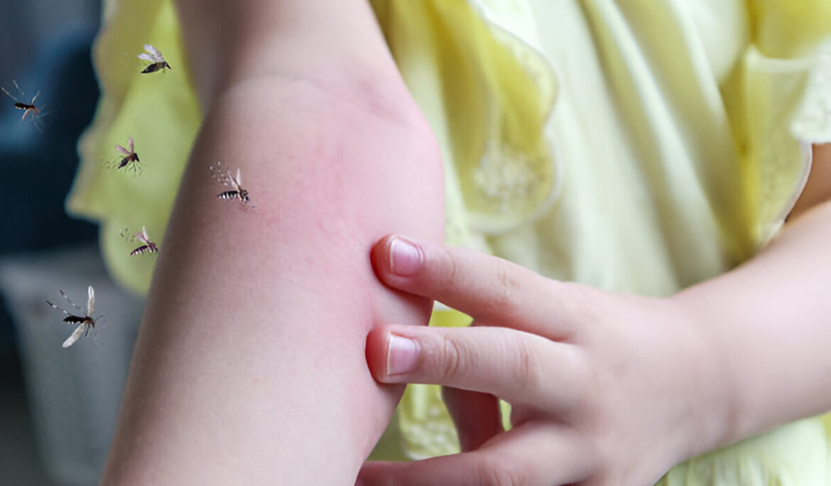 Dengue Fever in Children: Guide to Symptoms, Stages, Treatment - Empat Pillar Medika