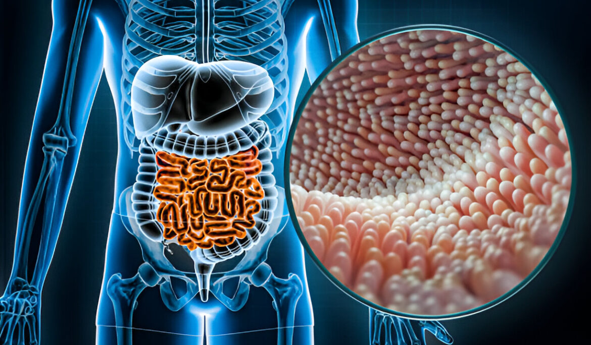 Understanding Celiac Disease: Your Complete Guide to Symptoms, Causes, and Treatment in 2024 - Empat Pillar Medika