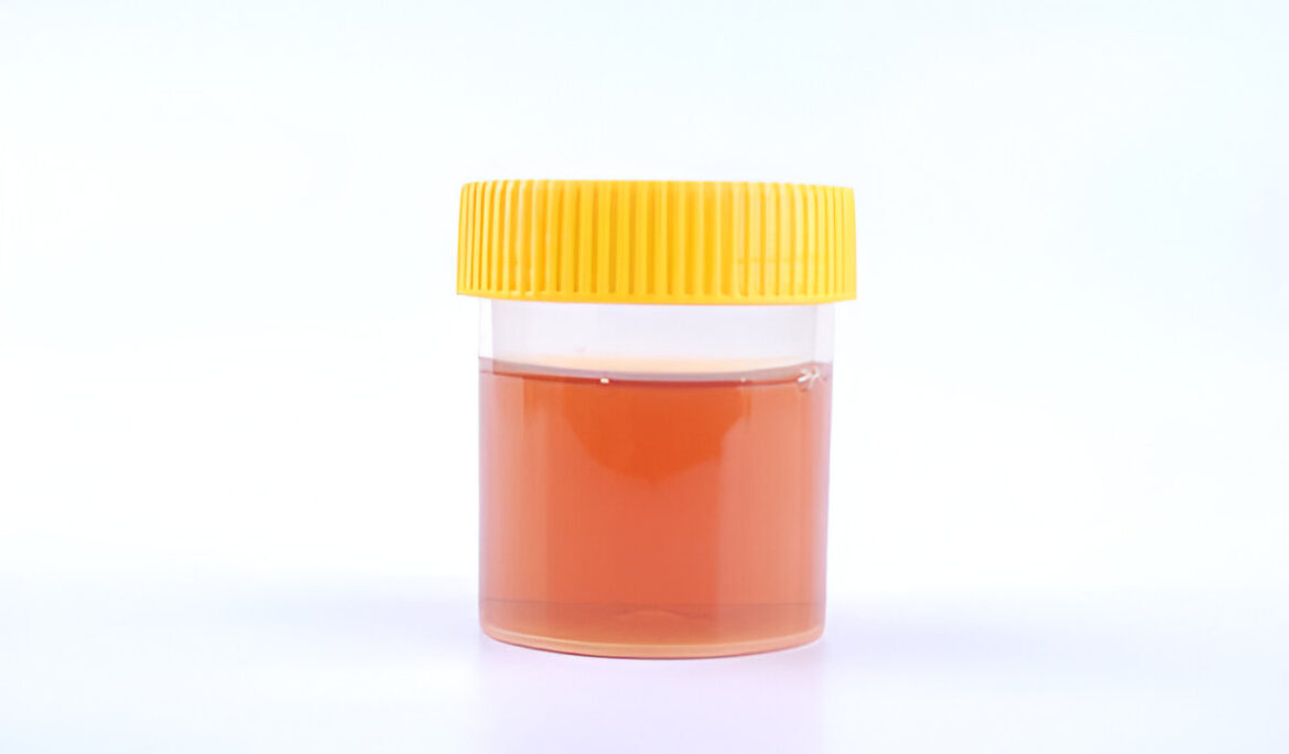 Foamy Urine: A Complete Guide to Causes, Symptoms, and Treatment Options - Empat Pillar Medika