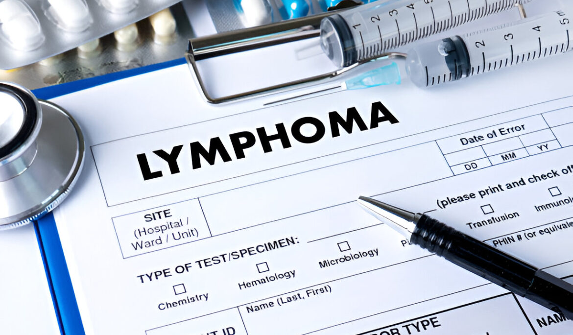 Hodgkin Lymphoma - Empat Pillar Medika