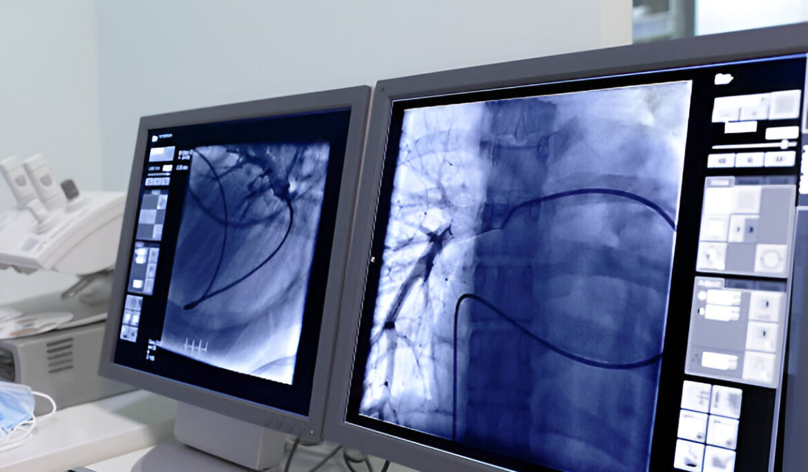 Lung Cancer Surgery: Your Options, Recovery, and Success - Empat Pillar Medika