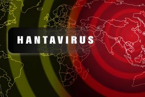 What is Hantavirus - Empat Pillar Medika